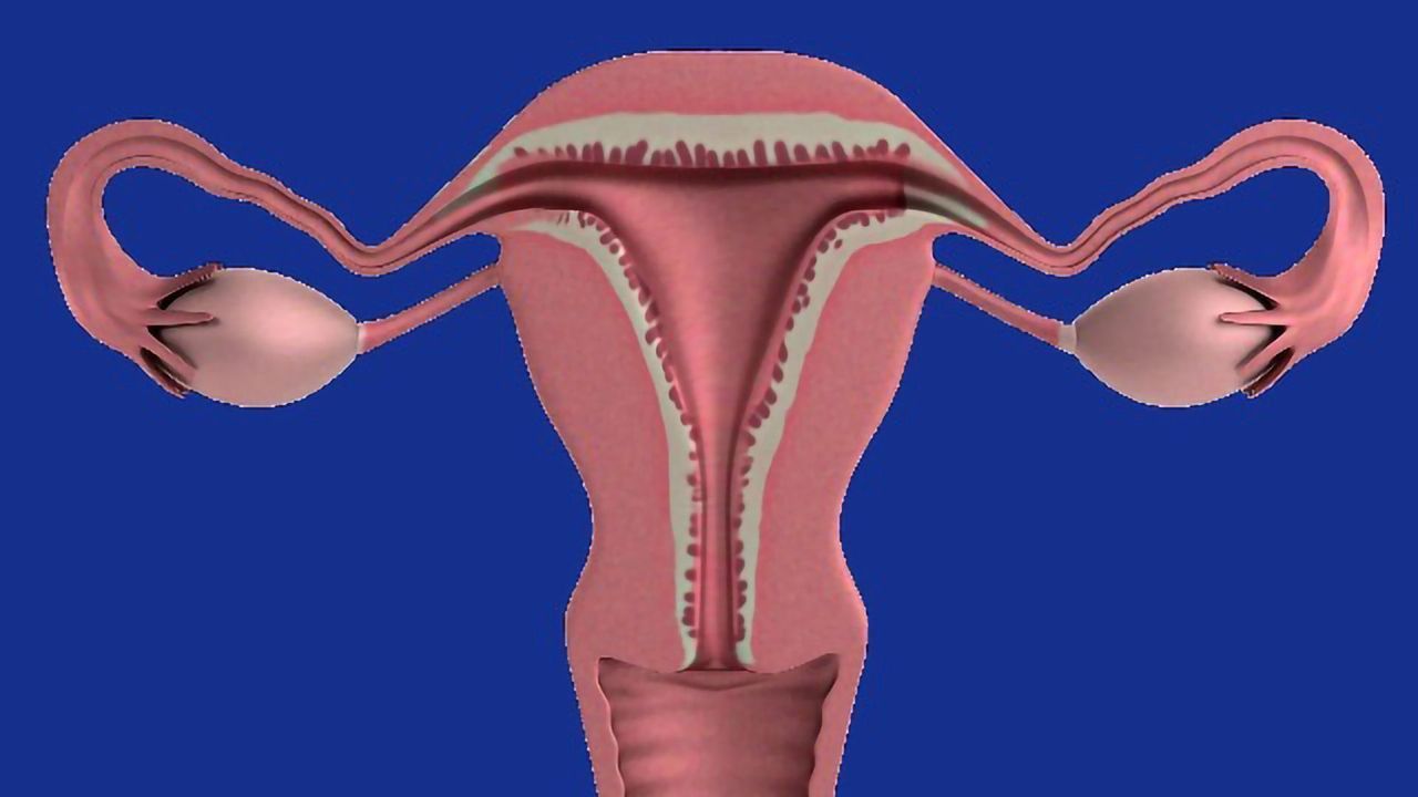 Blood Test Can Help GPs Spot Ovarian Cancer in Women With Suspicious Symptoms
