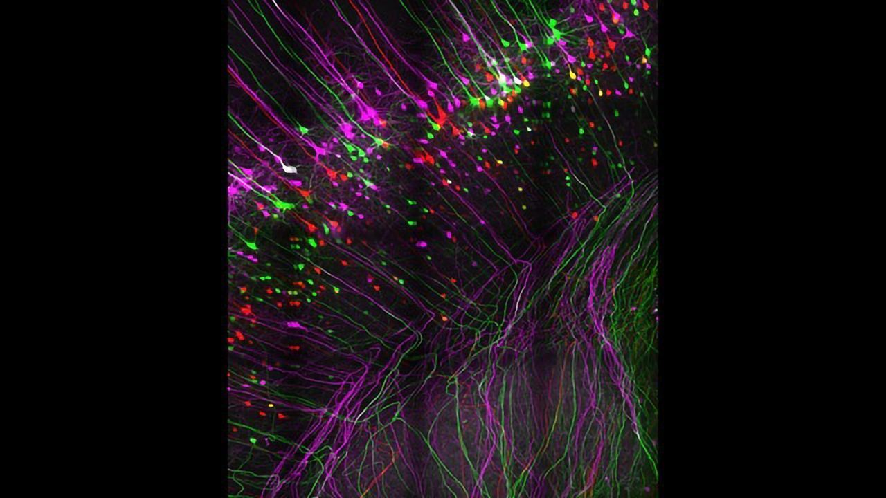 Protein Puts the Brakes on Nerve Growth