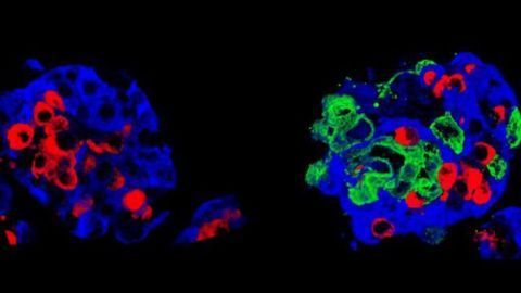 “Super-grafts” That Could Treat Diabetes