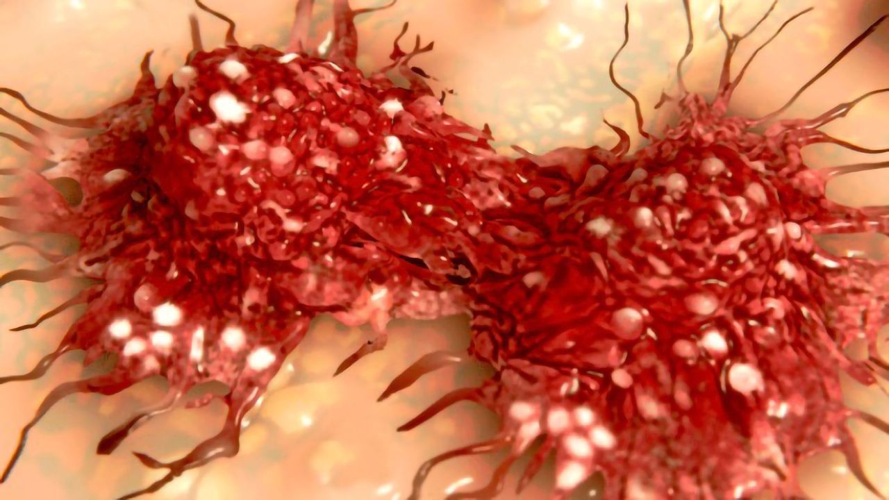 Vitamin D Dials Down Melanoma Cells’ “Aggressive Behavior”