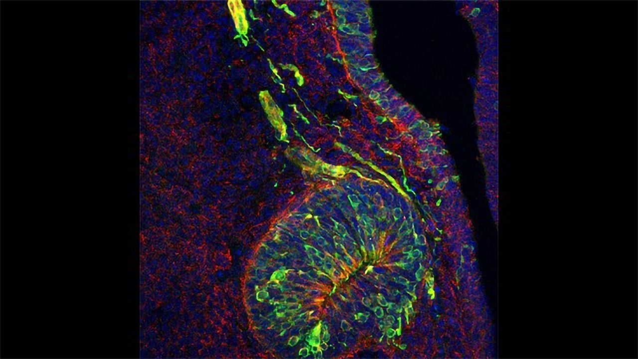 Puberty and Sense of Smell: What Do They Have in Common?