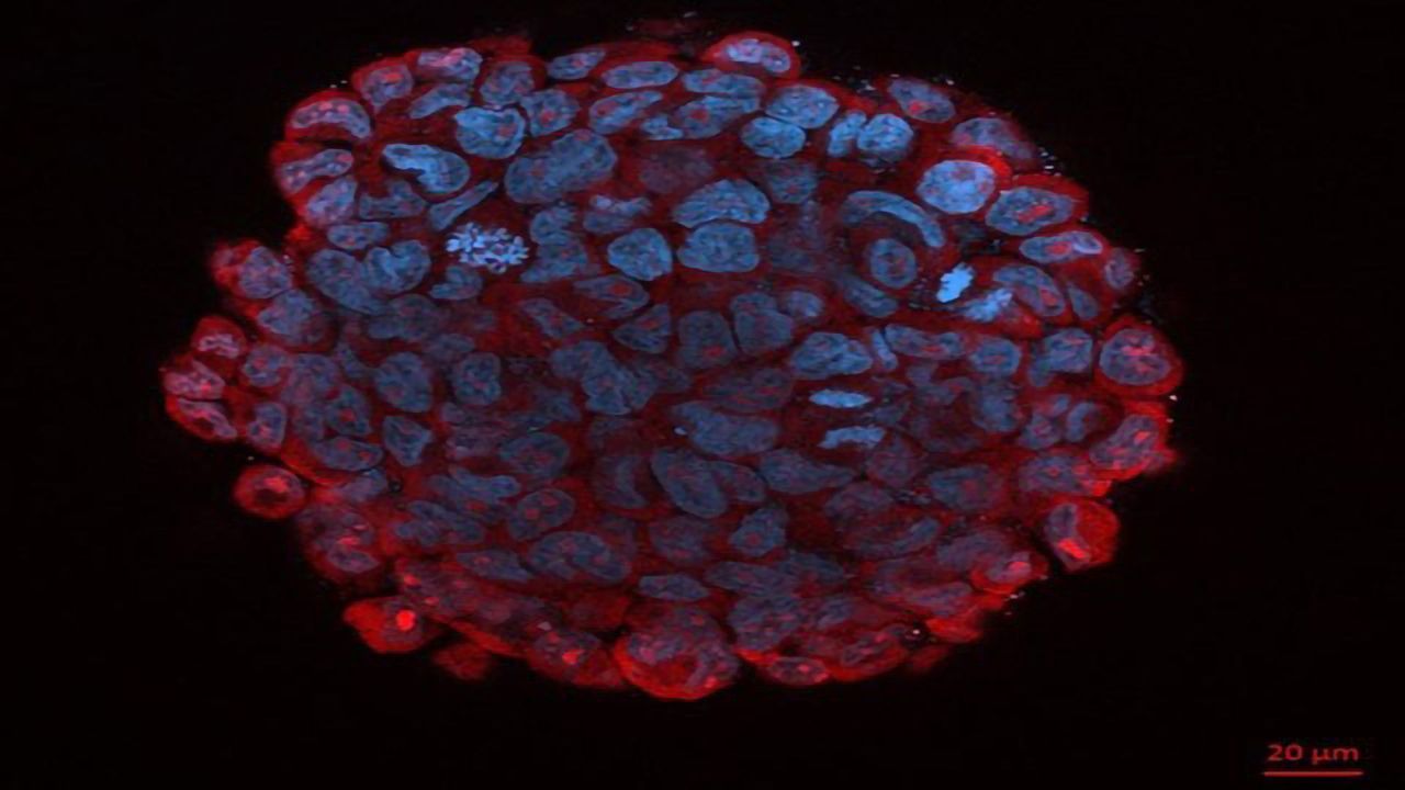 Novel Molecule Reduces the Aggressiveness of Pediatric Cancer