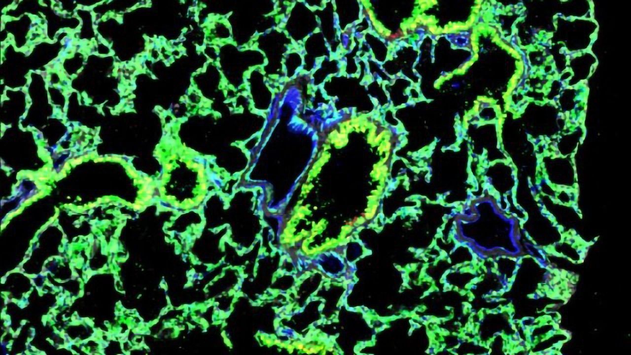 Stem Cell Transplants Used To Grow Fully Functional Lungs in Mice