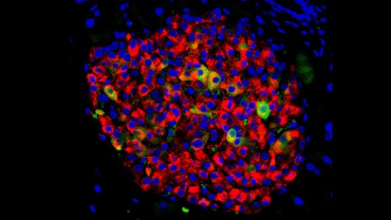 A New Treatment Approach for Type 2 Diabetes?