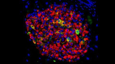 A New Treatment Approach for Type 2 Diabetes?