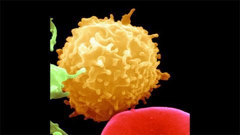 A Tailored Cancer Therapy Based on HLA Gene Profile?