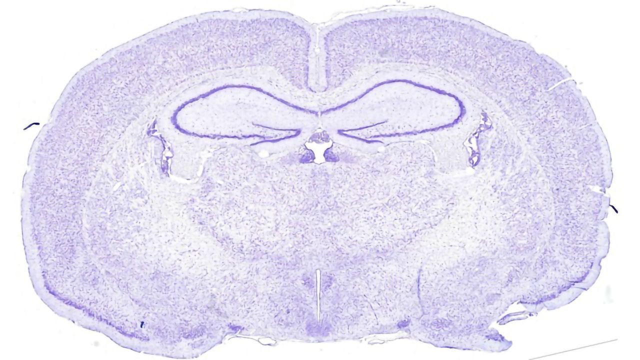 Stress Hormone Helps Control Brain Cells' Circadian Rhythm