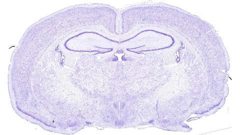 Stress Hormone Helps Control Brain Cells' Circadian Rhythm