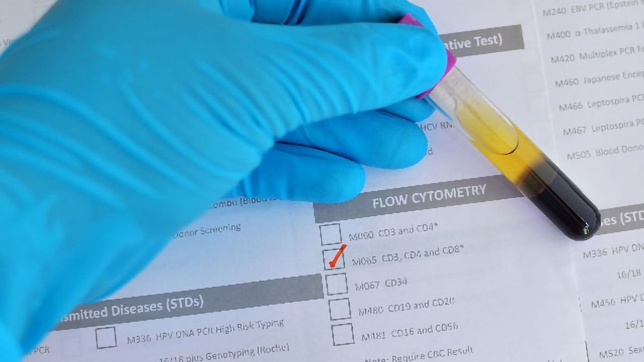 The Value and Versatility of Clinical Flow Cytometry