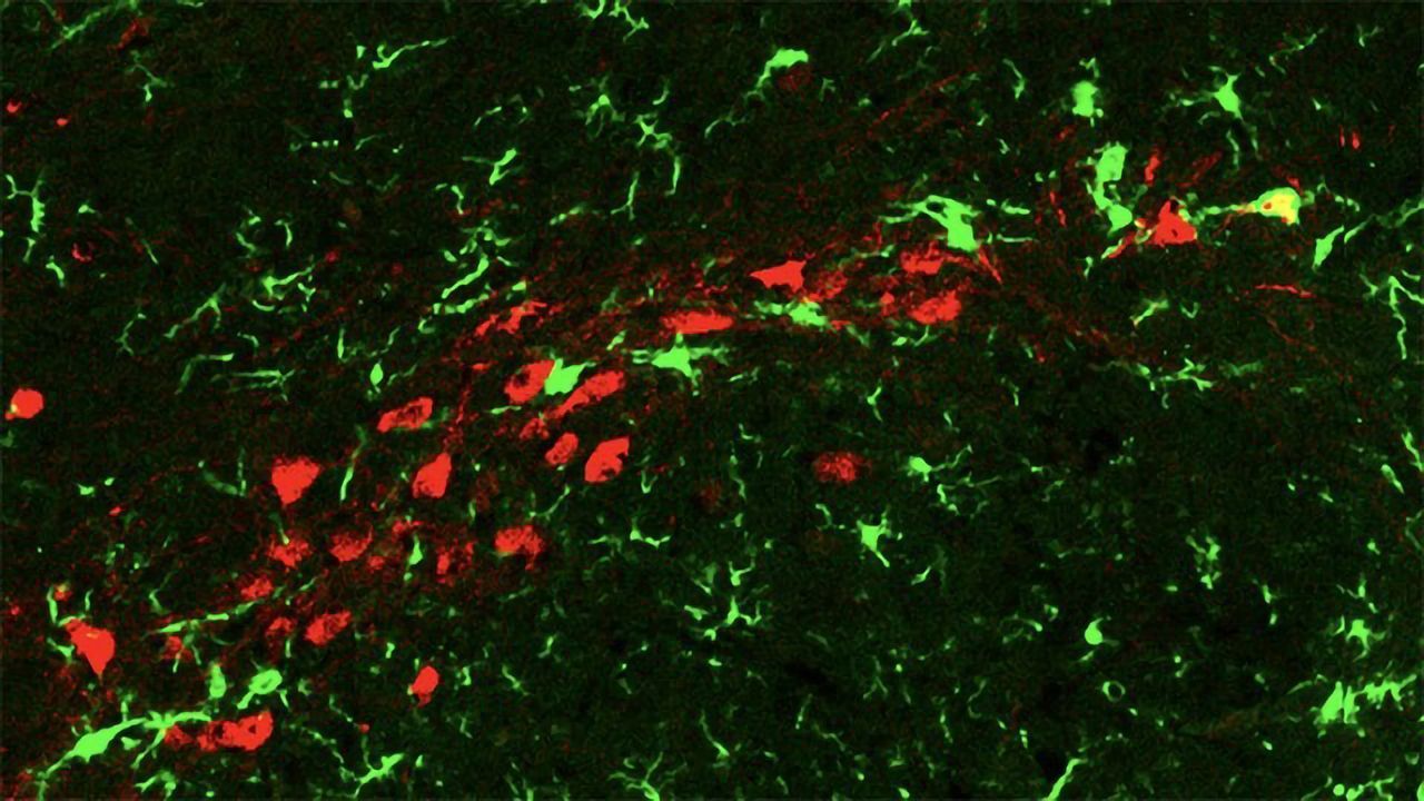 A Surprising Twist in the Pathway to Parkinson's