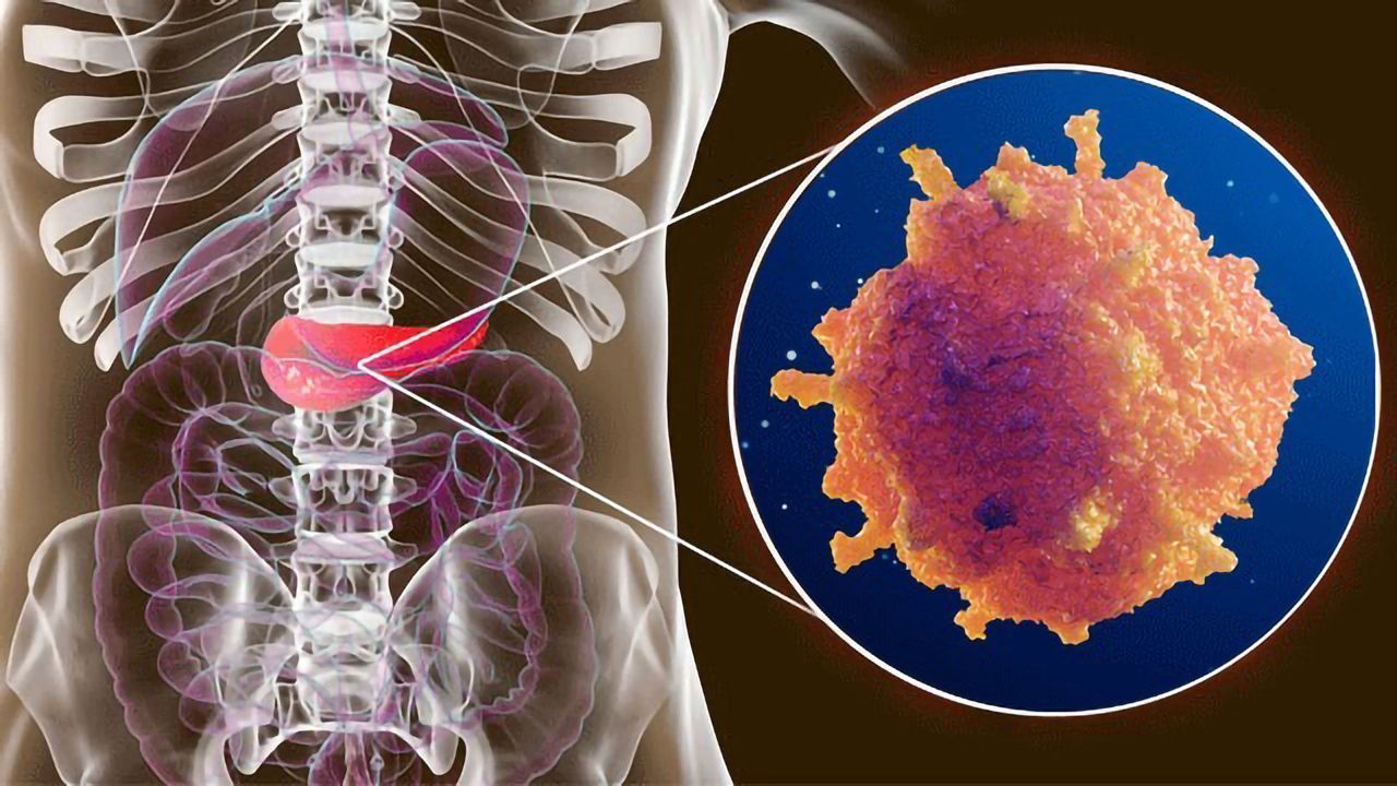 CD9 Protein – A Potential Drug Target for Pancreatic Cancer