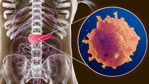 CD9 Protein – A Potential Drug Target for Pancreatic Cancer