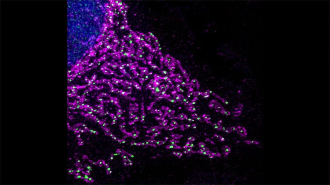 Oxygen Deficiency Rewires Mitochondria