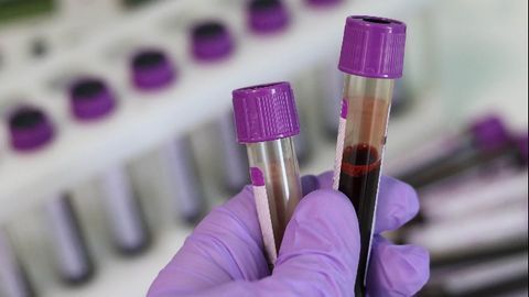 Moving Diagnostics Out of the Lab and Into Your Hand