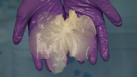 A Step Closer to a Bioengineered Liver Fit for Transplantation