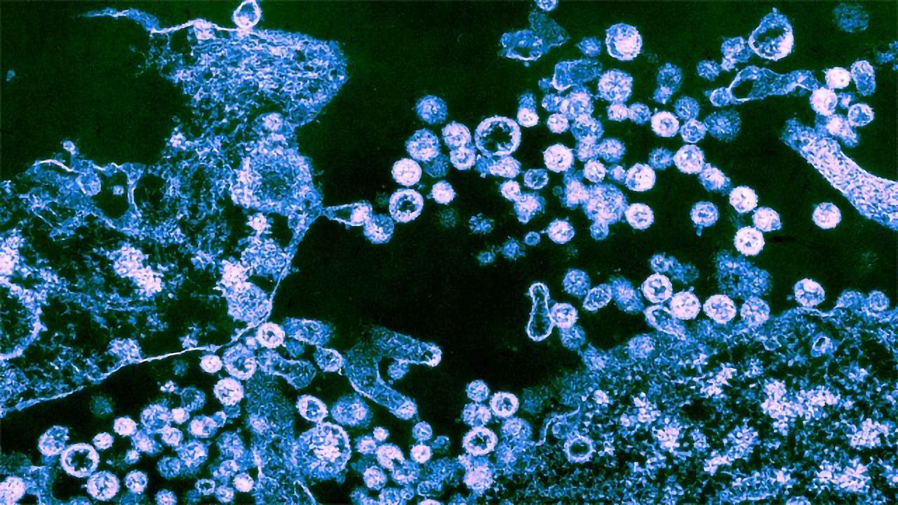 Lassa Virus