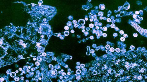 Lassa Virus