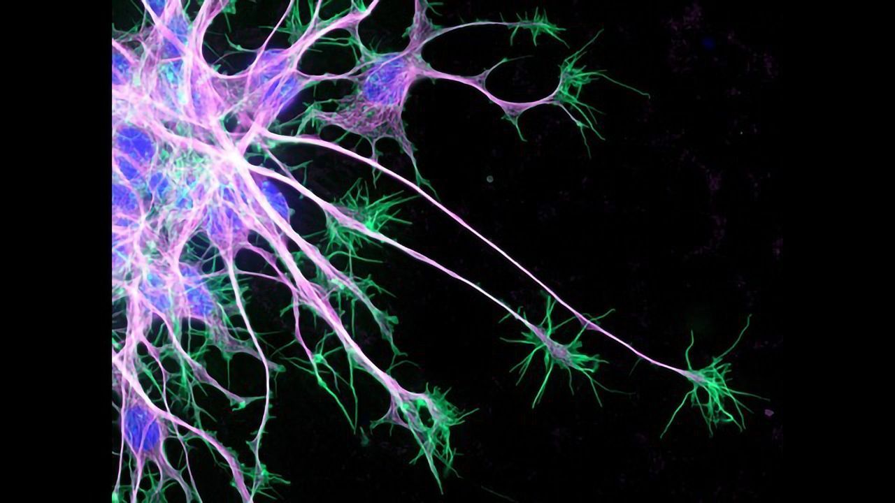 Neuron Growth