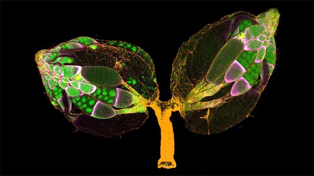 Fruit Fly Ovaries