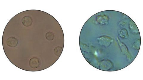 Leukemia Cells Transform Into Non-cancerous Cells