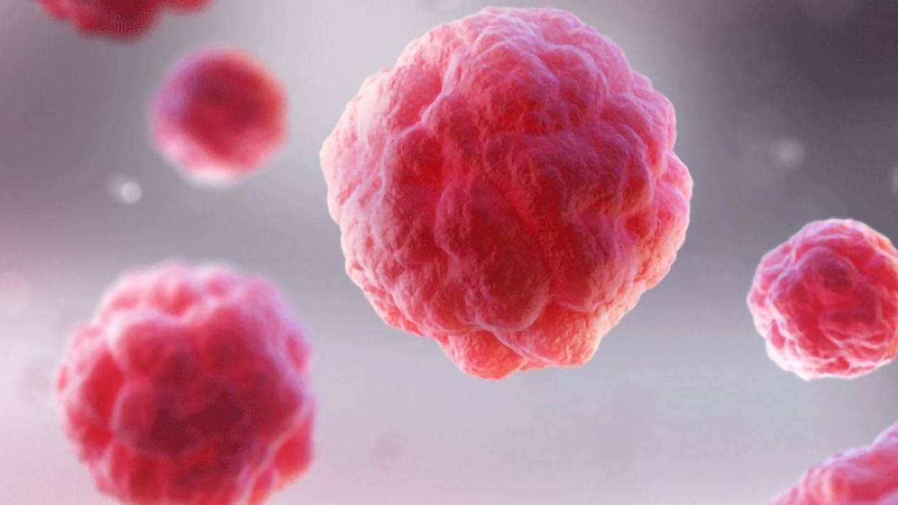 A Change in Cell Logistics Helps Cancer Become Resistant