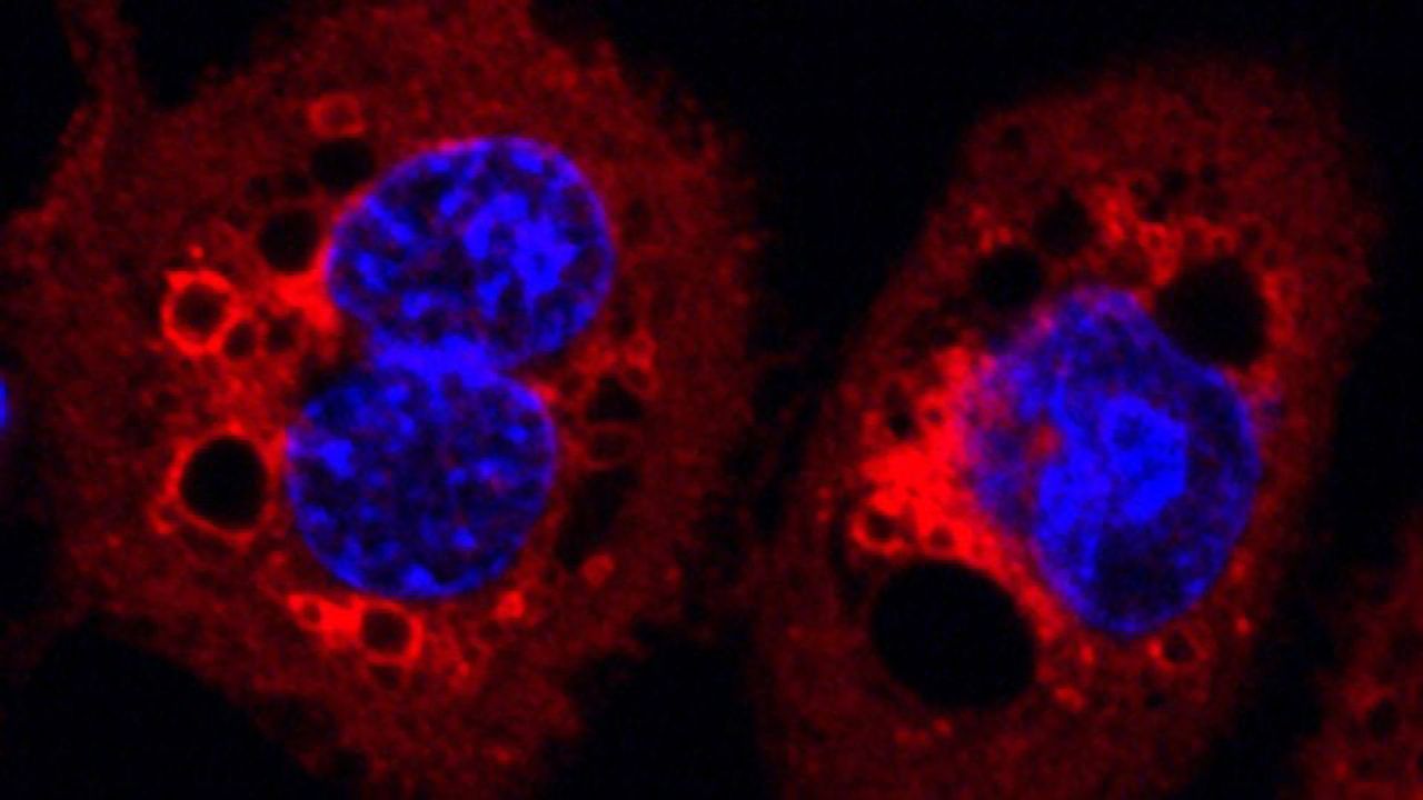 Bacterial Protein Impairs Important Cellular Processes