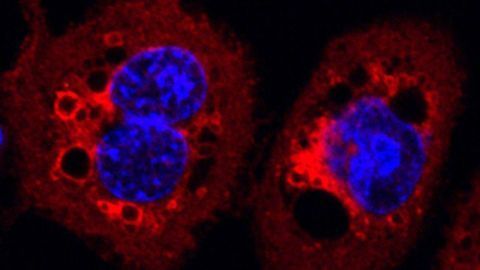 Bacterial Protein Impairs Important Cellular Processes