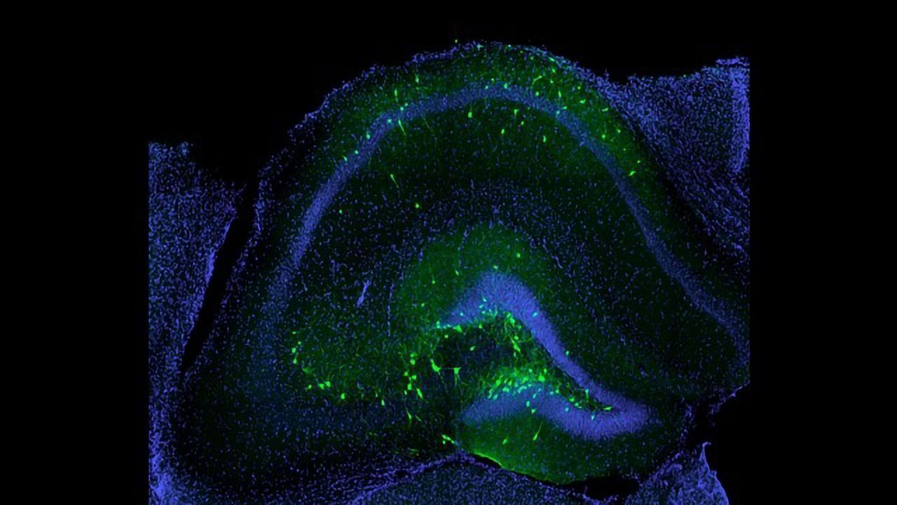 Cell Therapy Aims To Improve Memory and Prevent Seizures Following Traumatic Brain Injury