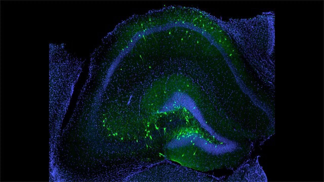 Transplanted Inhibitory Neurons