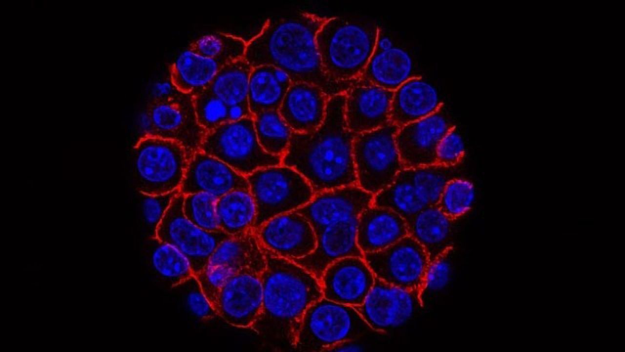 Compound Combo Shrinks Pancreatic Tumors in Mice Providing Rationale for Clinical Study