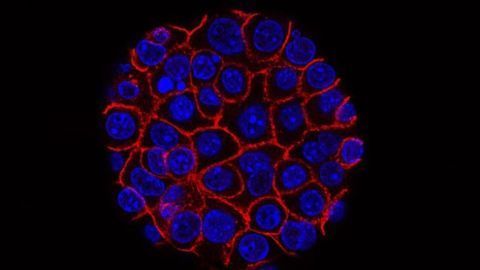 Compound Combo Shrinks Pancreatic Tumors in Mice Providing Rationale for Clinical Study