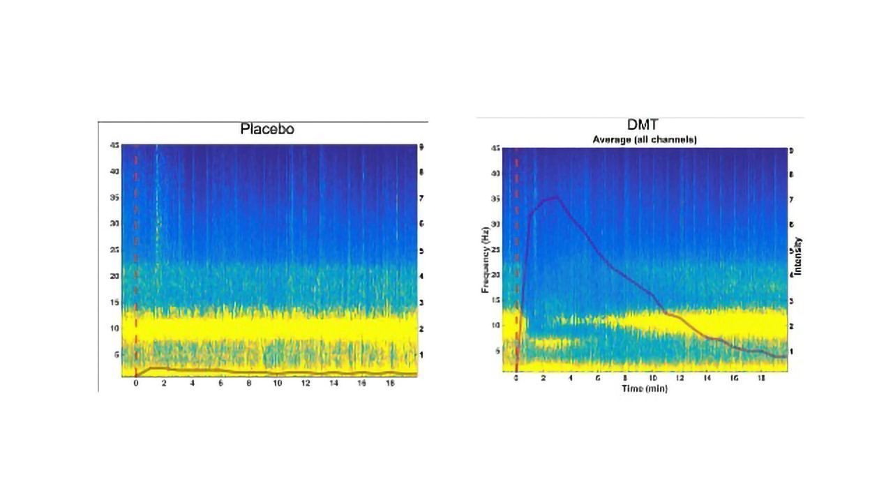 Ayahuasca's "Waking-dream" State Revealed by Brainwave Analysis