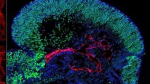 Complex Organ Models Grown in the Lab