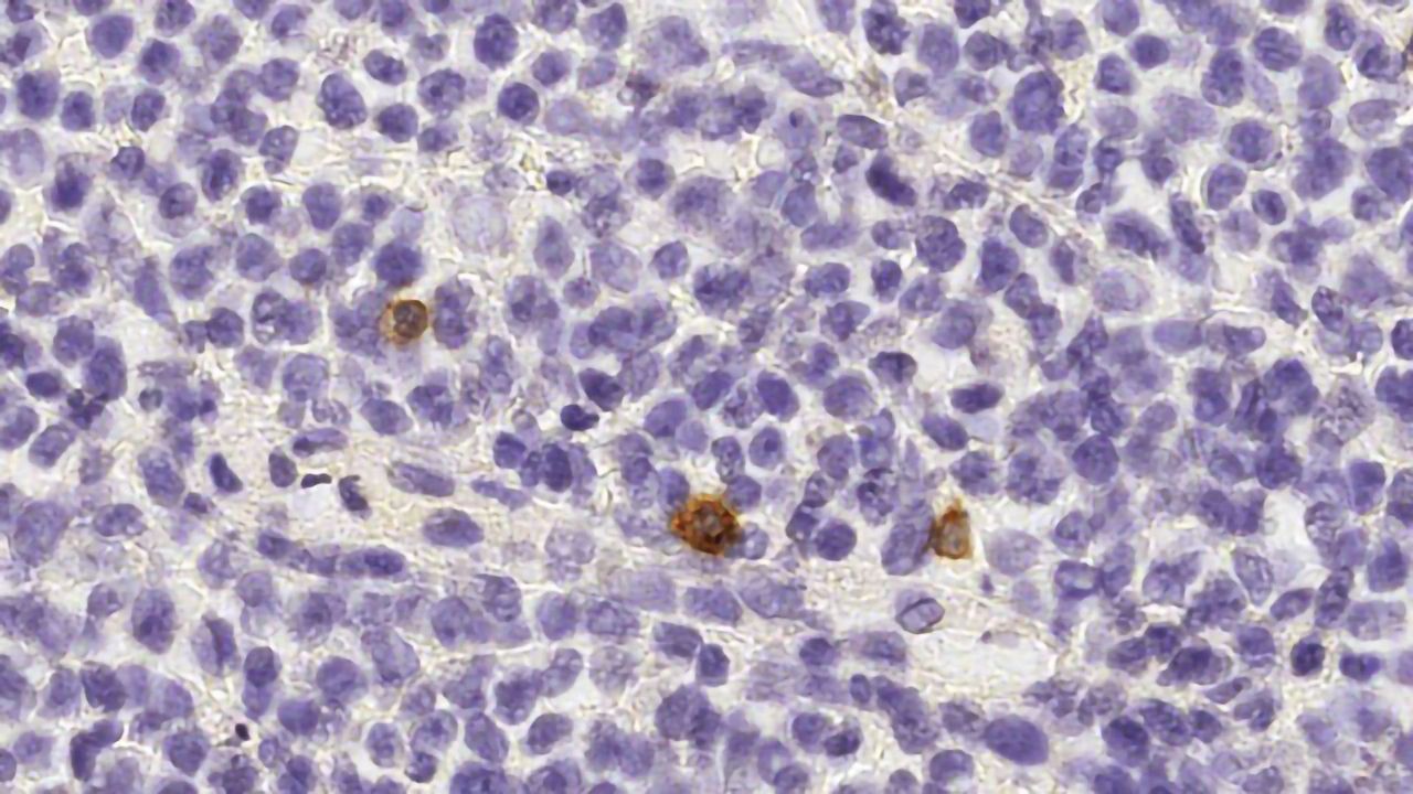 A New Pathway To "Reprogram" Killer Cells