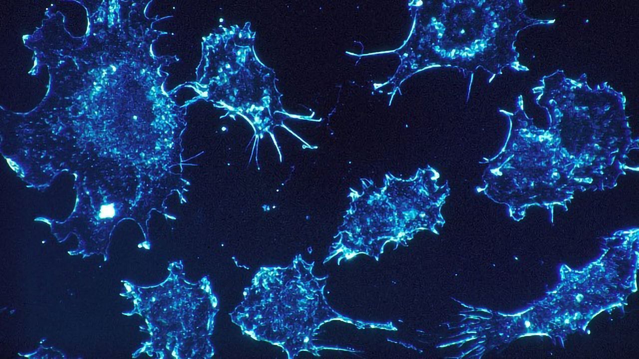 Cell Death or Cancer Growth: A Question of Cohesion
