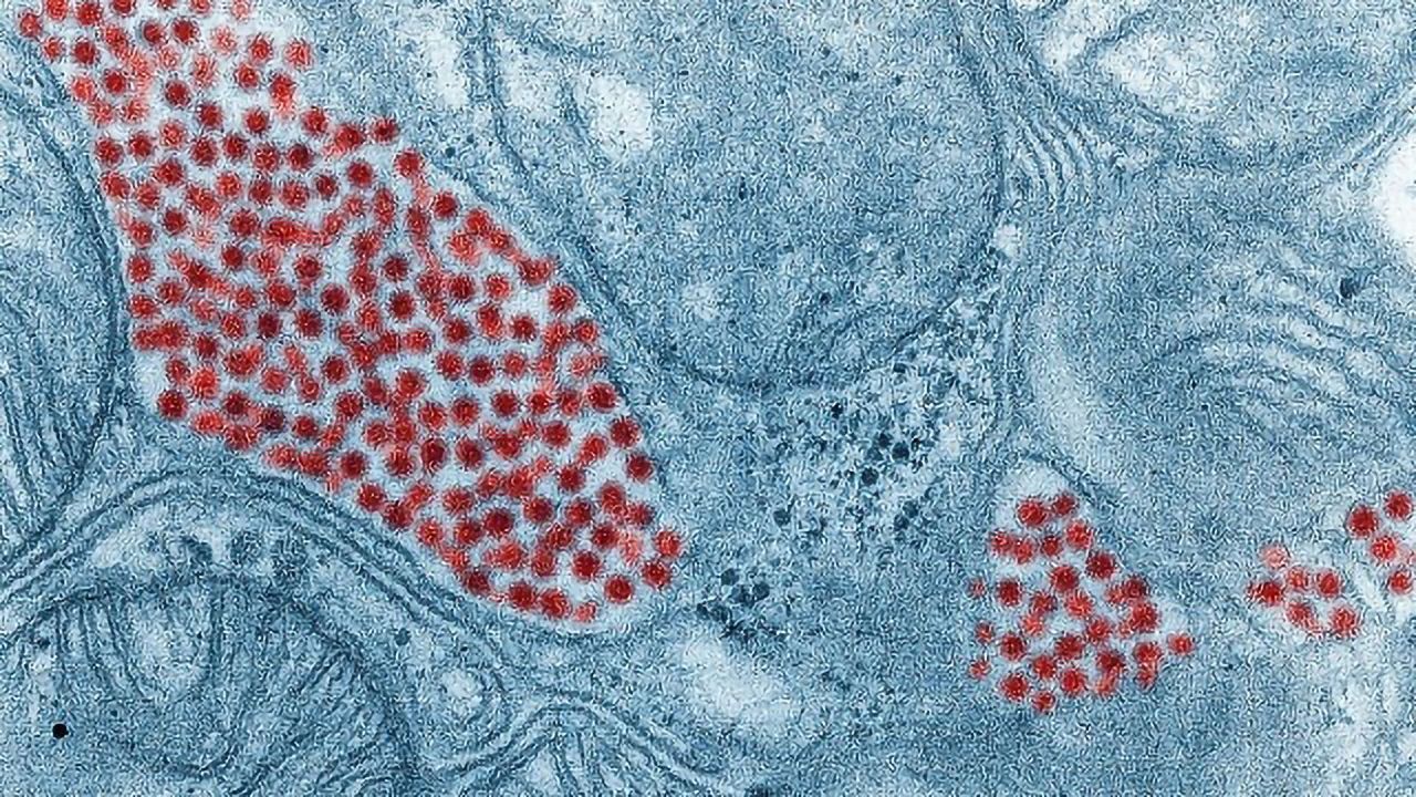 Looming Threat From Eastern Equine Encephalitis Virus