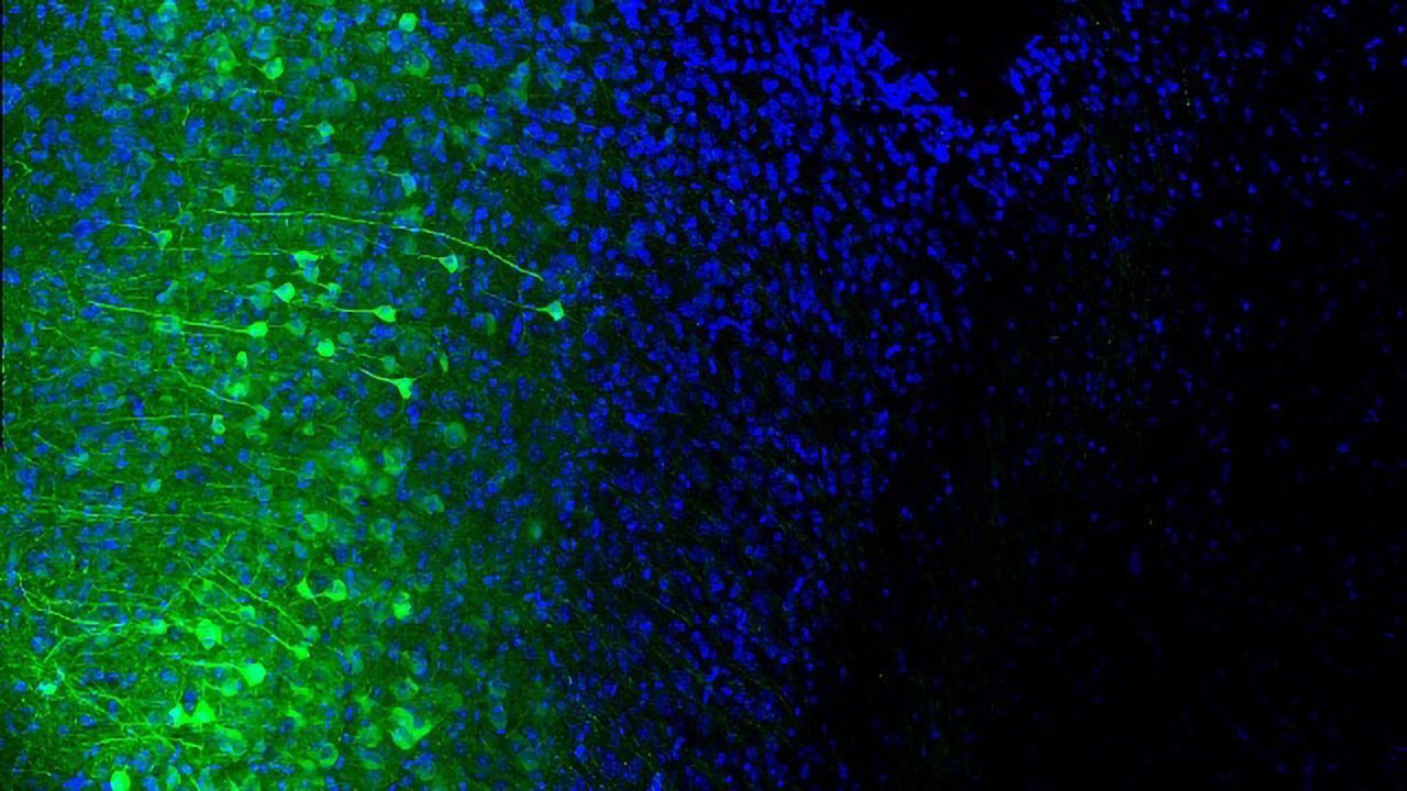 Mouse Biomarker Predicts Compulsive Drinking