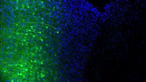 Mouse Biomarker Predicts Compulsive Drinking