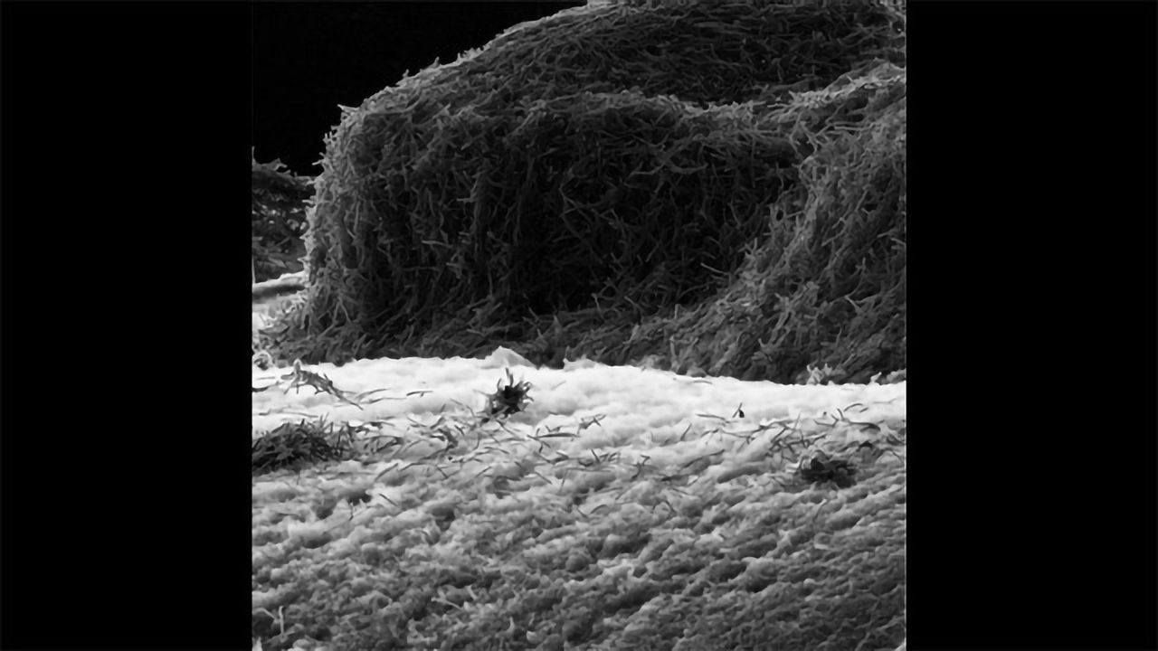 Taking a Closer Look at Phage-Cell Interactions