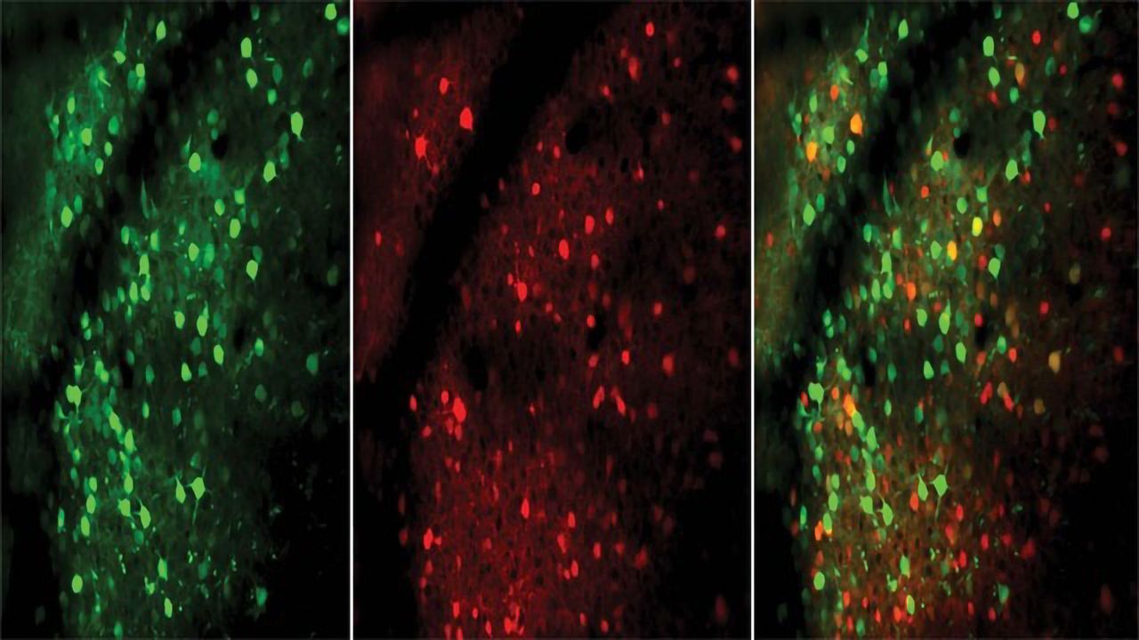 Excitatory vs. Inhibitory Neurons