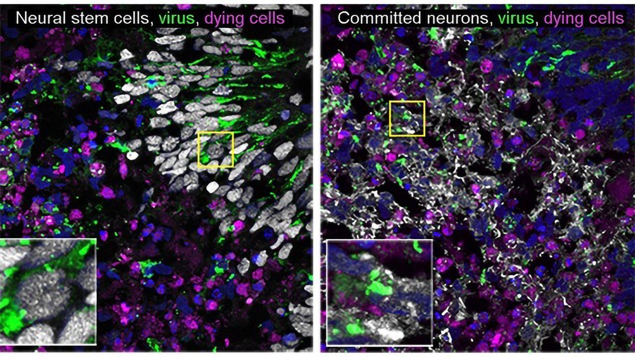 Brain Organoids Offer Clues to Neuron-killing Virus