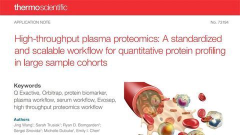High-throughput Plasma Proteomics: A Standardized and Scalable Workflow for Quantitative Protein Profiling in Large Sample Cohorts