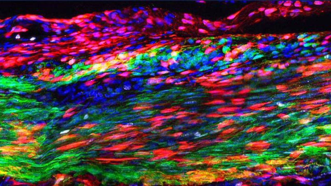 Revolutionizing Injury Recovery With Tendon Stem Cells