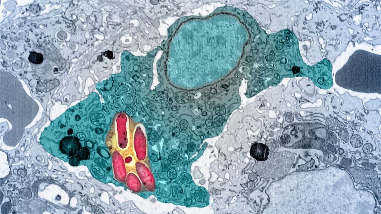 Infected Macrophage