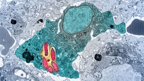 Infected Macrophage