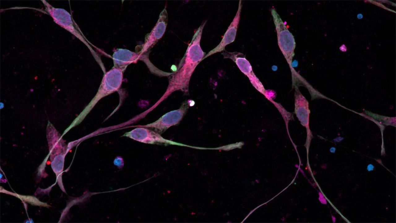Glioma Cells
