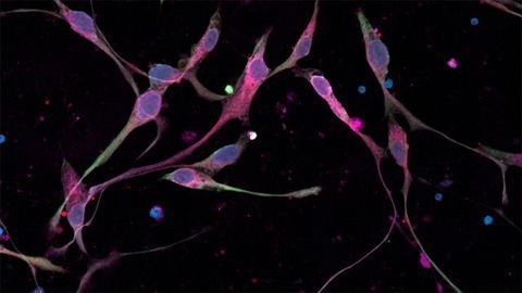 Glioma Cells