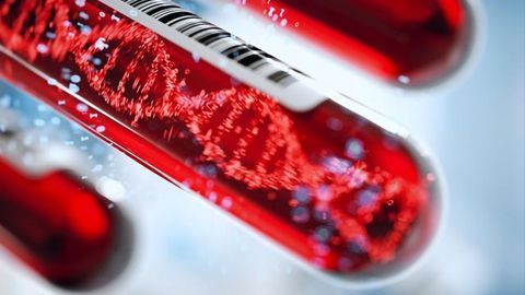 A New Way To Detect More Cancers Earlier
