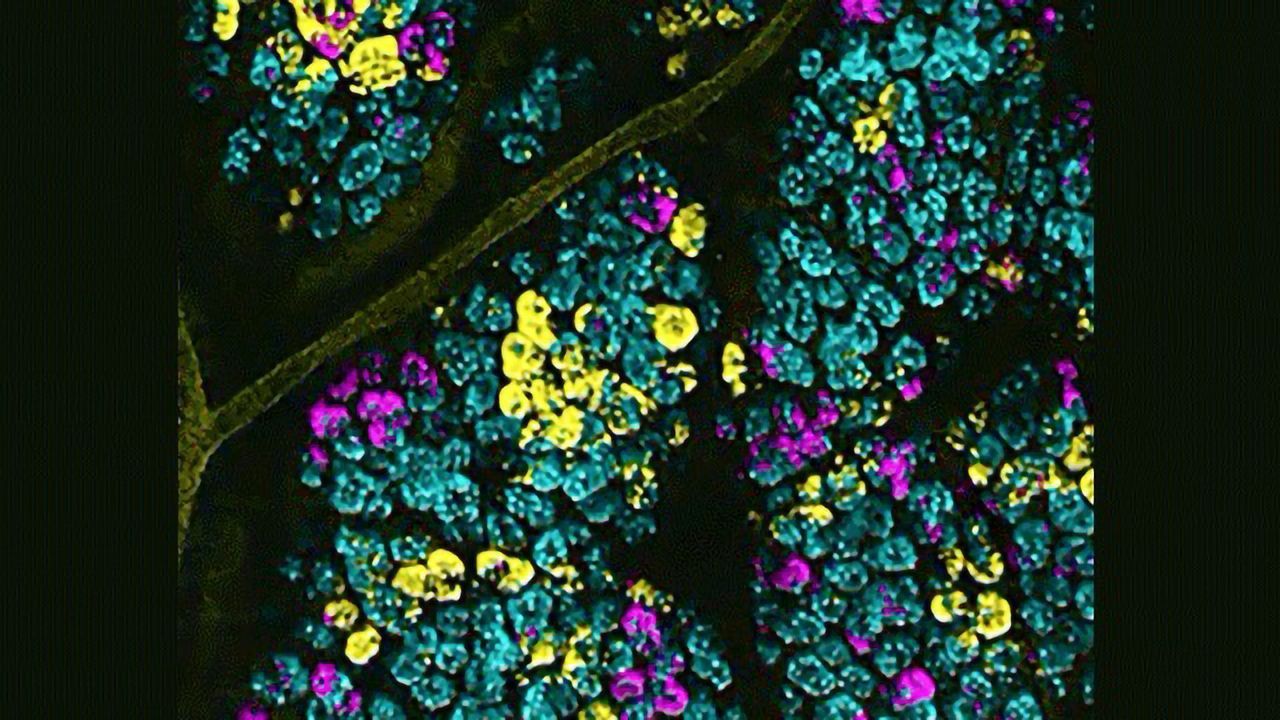 Glow-in-the-Dark Cells Expose Mutations Driving Malignancy