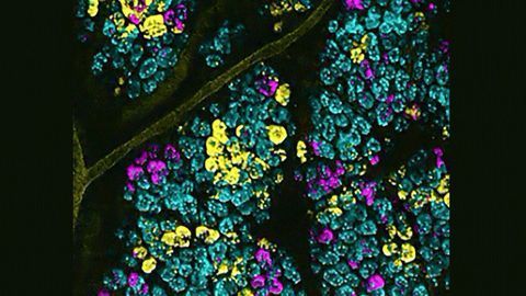 Glow-in-the-Dark Cells Expose Mutations Driving Malignancy